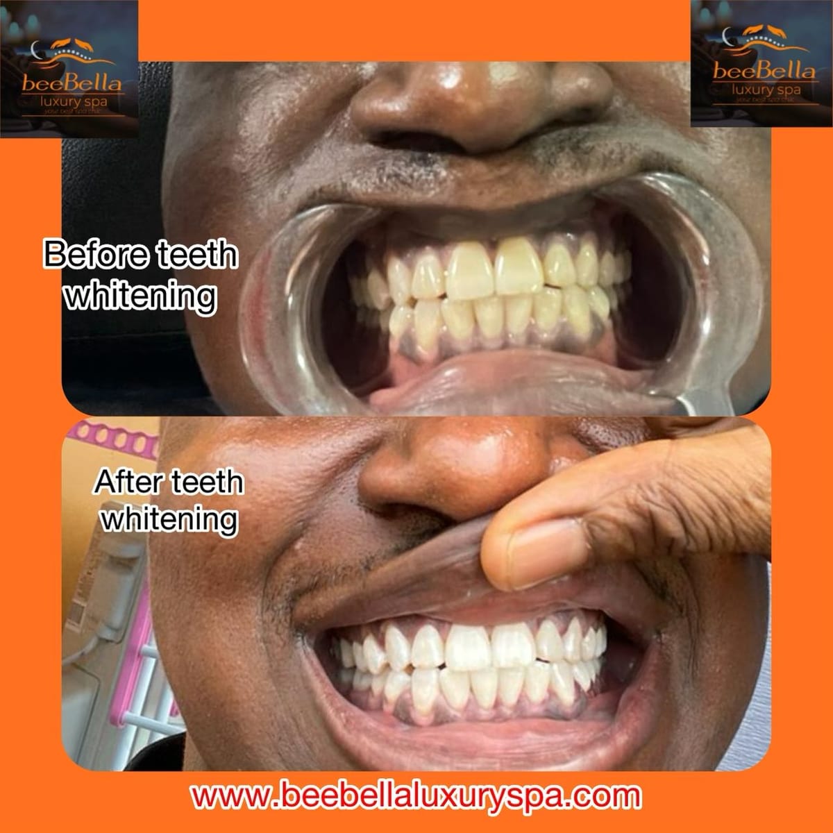Smile care